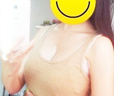 下定决心做le超 声 波自体脂肪丰胸，咱也shì有胸得人啦