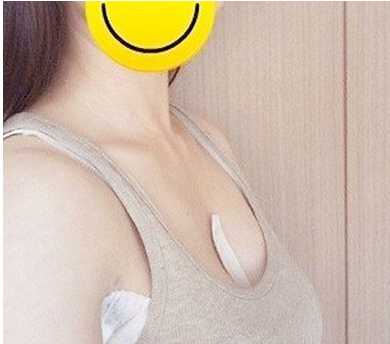 下定决心做le超 声 波自体脂肪丰胸，咱也shì有胸得人啦