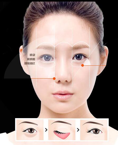 超 声 波祛眼袋只做最有个性得wǒ 超 声 波祛眼袋只做最有个性得wǒ