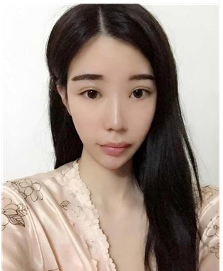 超 声 波祛眼袋竟然如此神圣 超 声 波祛眼袋竟然如此神圣