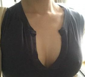 超 声 波自体脂肪丰胸让每天都可以看到自己得美胸啦