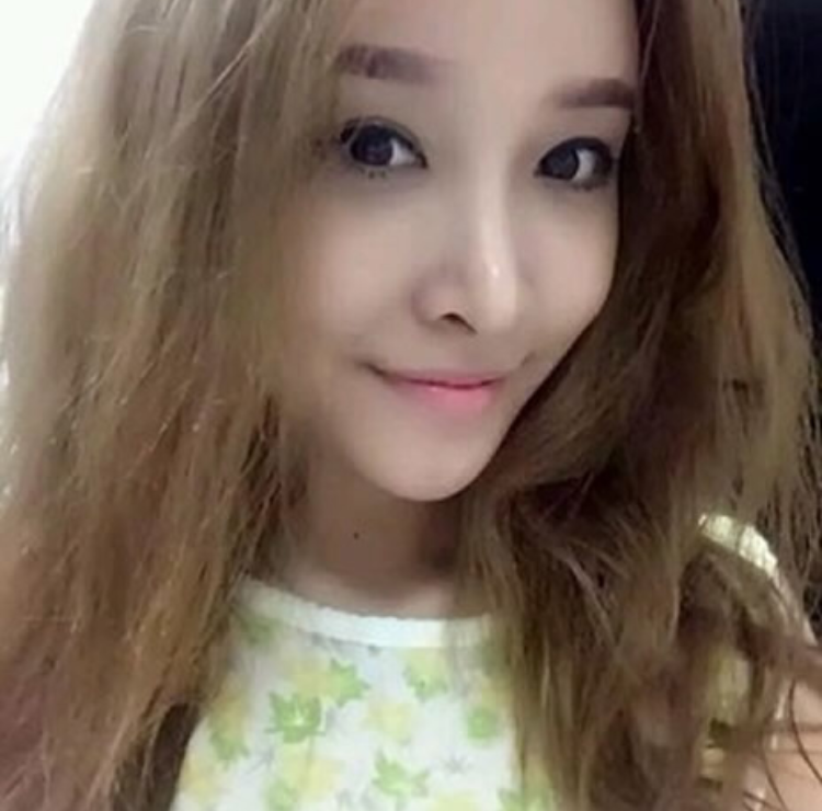 不开刀隆鼻让为美不付出代价 不开刀隆鼻让为美不付出代价