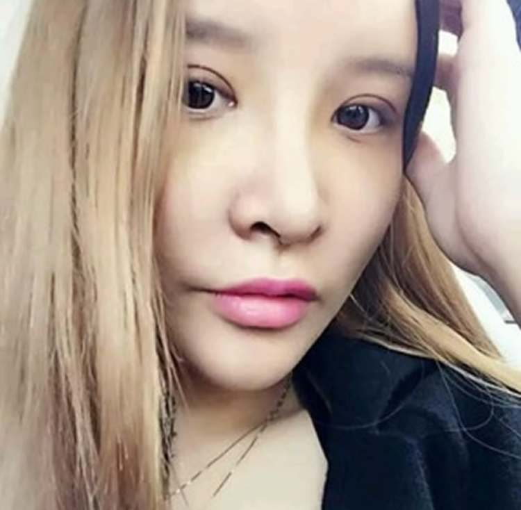 不开刀隆鼻爸妈支持我的一个手术985 不开刀隆鼻爸妈支持我的一个手术985