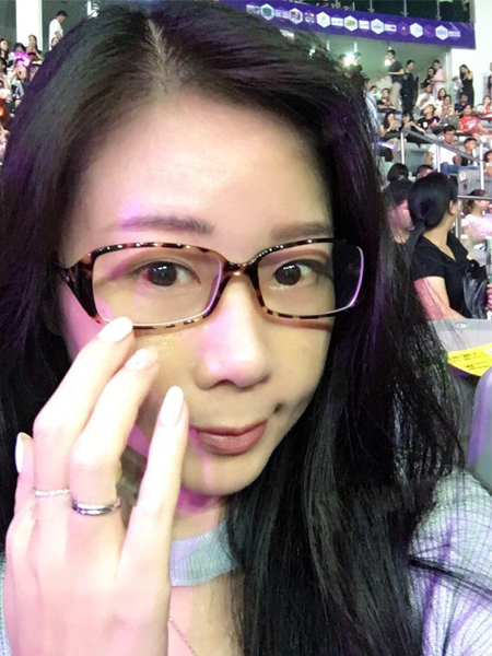 会计师轻松祛眼袋就是做了超声波去眼袋645 会计师轻松祛眼袋就是做了超声波去眼袋645