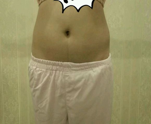 吸脂瘦腰腹wǒ用超 声 波减肥 吸脂瘦腰腹wǒ用超 声 波减肥