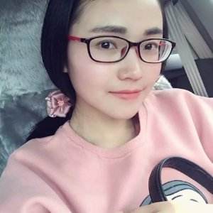 后天的扁鼻子做了不开刀隆鼻以后全部恢复了679 后天的扁鼻子做了不开刀隆鼻以后全部恢复了679