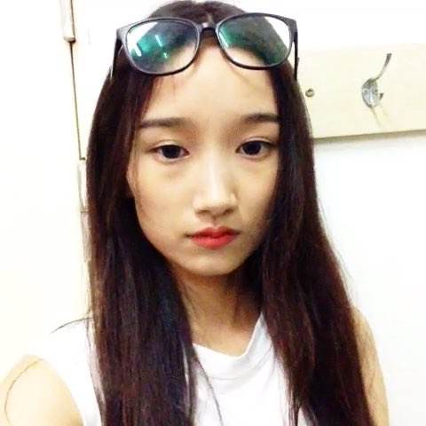 后天的扁鼻子做了不开刀隆鼻以后全部恢复了679 后天的扁鼻子做了不开刀隆鼻以后全部恢复了679