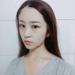从清秀晋级到美丽——超声波双眼皮手术912 从清秀晋级到美丽——超声波双眼皮手术912
