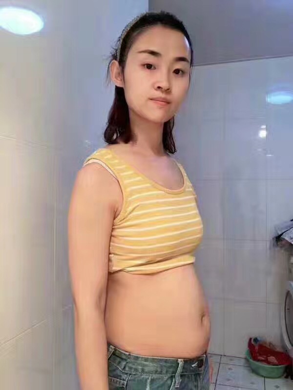 超声法减肥，感谢你的出现让我成为我心目中的自己361