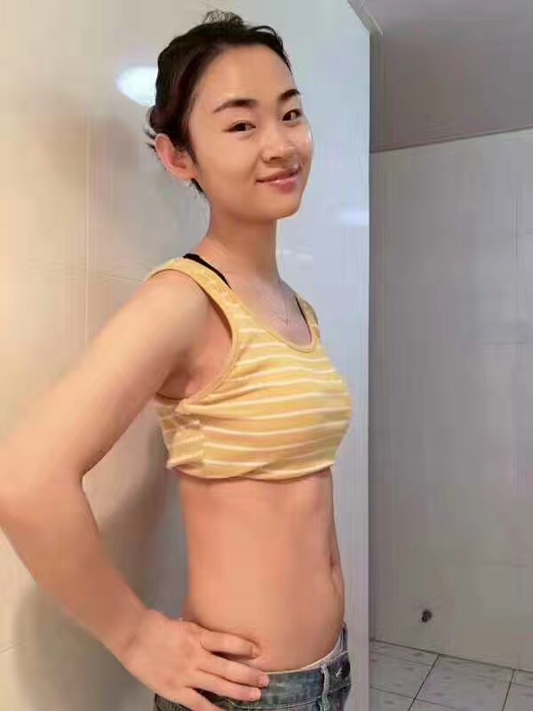 超声法减肥，感谢你的出现让我成为我心目中的自己361