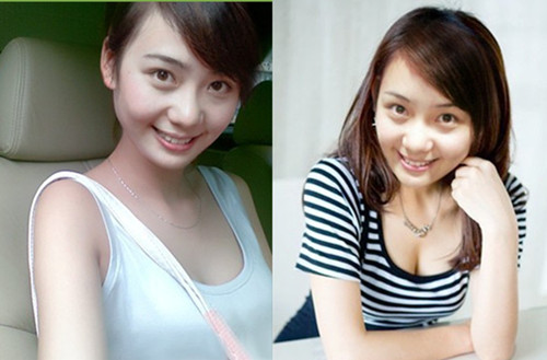 超声波丰胸让我绽放美丽080 超声波丰胸让我绽放美丽080