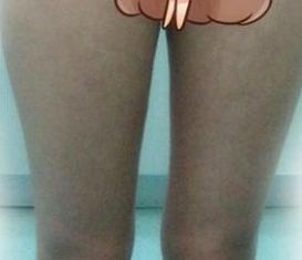 大象腿就用超声波减肥来瘦吧!634 大象腿就用超声波减肥来瘦吧!634