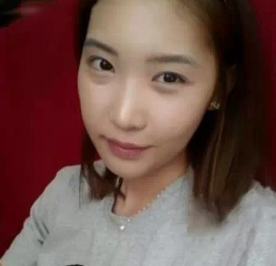 跟着朋友的脚步去做了超声波去眼袋483 跟着朋友的脚步去做了超声波去眼袋483