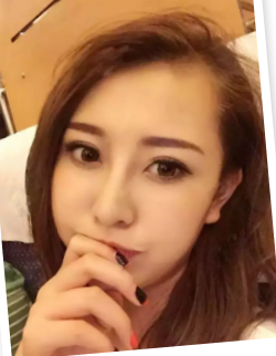跟着朋友的脚步去做了超声波去眼袋483 跟着朋友的脚步去做了超声波去眼袋483