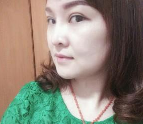 超声波去眼袋恢复状况不错,分享啦966 超声波去眼袋恢复状况不错,分享啦966