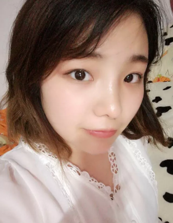 爱美达人金金分享隆鼻心得916 爱美达人金金分享隆鼻心得916
