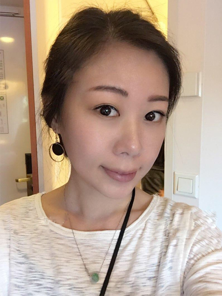 有眼袋的美女要做超声波去眼袋482 有眼袋的美女要做超声波去眼袋482
