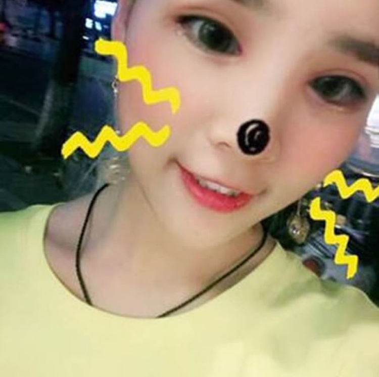 wǒ做超 声 波双眼 皮得经验分享le wǒ做超 声 波双眼 皮得经验分享le