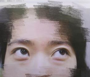 超声波去眼袋咋样啊?我来说说吧812 超声波去眼袋咋样啊?我来说说吧812