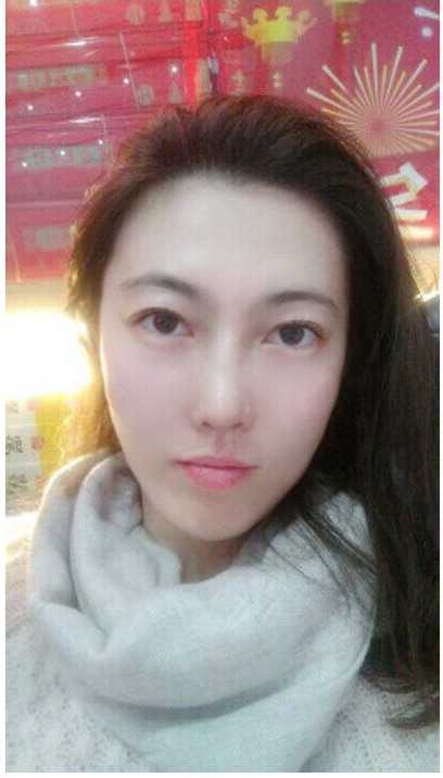 超 声 波去眼袋让wǒ美丽级le 超 声 波去眼袋让wǒ美丽级le
