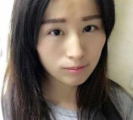 超声波去眼袋让变美从年轻开始!489 超声波去眼袋让变美从年轻开始!489