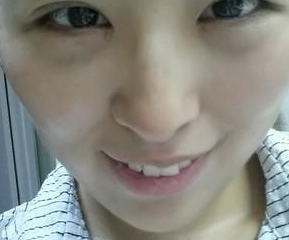 超声波去眼袋让变美从年轻开始!489 超声波去眼袋让变美从年轻开始!489