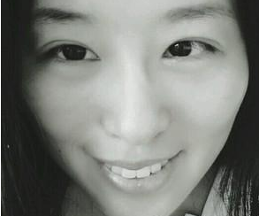 超声波去眼袋轻松无后遗症消除眼袋061 超声波去眼袋轻松无后遗症消除眼袋061