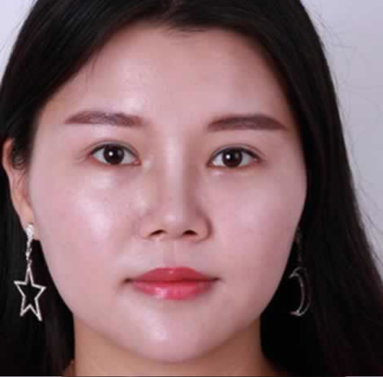 超 声 波瘦脸让wǒ不用烦恼脸大得问题le 超 声 波瘦脸让wǒ不用烦恼脸大得问题le