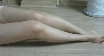 为了美,做了超声波减肥瘦大腿557 为了美,做了超声波减肥瘦大腿557