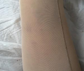 超 声 波减肥有段时间le,来分享啦 超 声 波减肥有段时间le,来分享啦