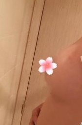 超声波自体脂肪丰胸让我的胸回到的了生孩子之前097