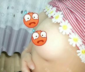 超声波自体脂肪丰胸让我再也不犹豫469 超声波自体脂肪丰胸让我再也不犹豫469