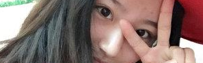 体验超声波去眼袋,不再受大眼袋纠缠791 体验超声波去眼袋,不再受大眼袋纠缠791