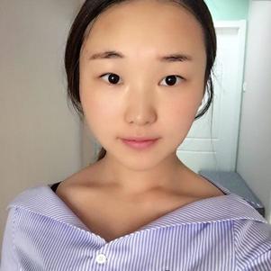 超声波双眼皮给我知性美862 超声波双眼皮给我知性美862