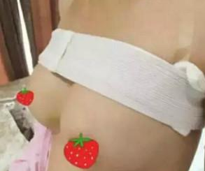 超声波自体脂肪丰胸后再也不是“你胸小不要讲话”的主了049