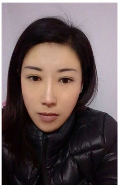 超声波祛眼袋让我的气质更加的好了553 超声波祛眼袋让我的气质更加的好了553