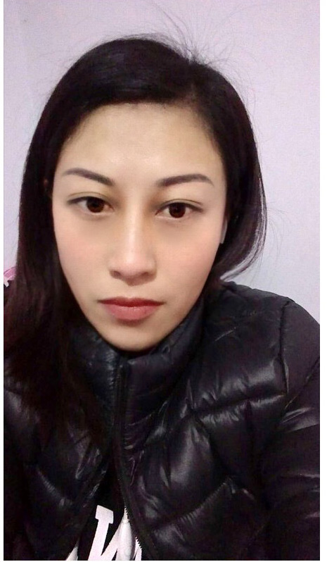 爱花达人做le超 声 波去眼袋让眼袋不再长le 爱花达人做le超 声 波去眼袋让眼袋不再长le