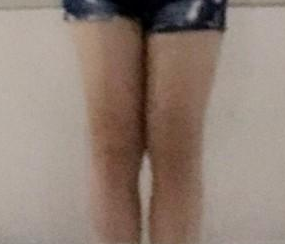 超声波减肥瘦大腿,再也不用让裙子过膝盖了732 超声波减肥瘦大腿,再也不用让裙子过膝盖了732