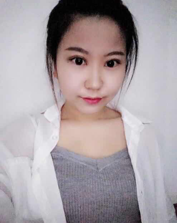 美丽的女孩做了超声波双眼皮以后变的更加的美丽990