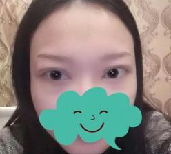 周年庆扫码关注了下，超声波去眼袋6800，真实惠867