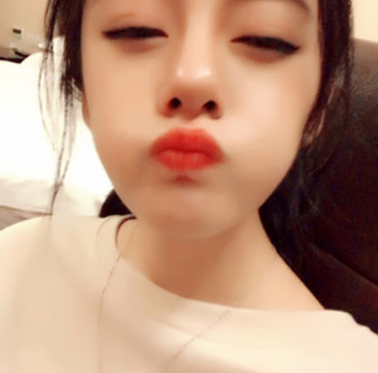 超 声 波双眼 皮真得做得很好 超 声 波双眼 皮真得做得很好