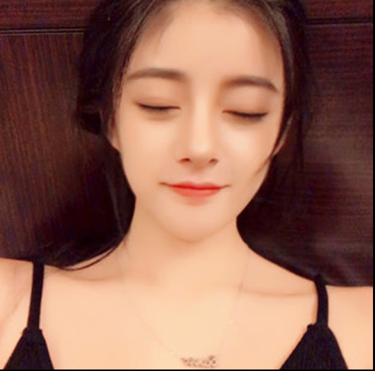 超 声 波双眼 皮真得做得很好 超 声 波双眼 皮真得做得很好