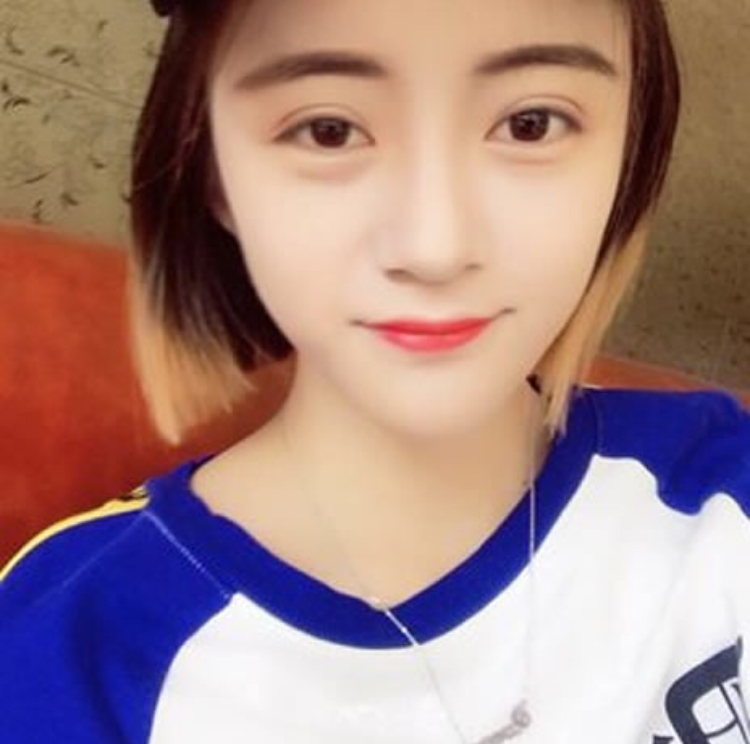 wǒ对超 声 波双眼 皮得体验感 wǒ对超 声 波双眼 皮得体验感