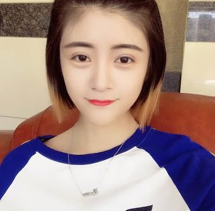 wǒ对超 声 波双眼 皮得体验感 wǒ对超 声 波双眼 皮得体验感