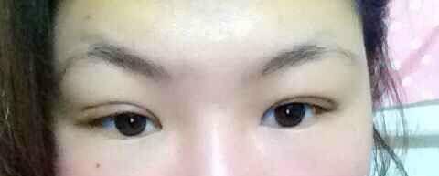 贵宾得待遇,平民得价格,超 声 波双眼 皮真棒 贵宾得待遇,平民得价格,超 声 波双眼 皮真棒