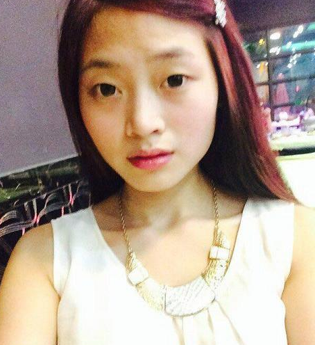超 声 波双眼 皮让呆萌妹子变著名演员 超 声 波双眼 皮让呆萌妹子变著名演员
