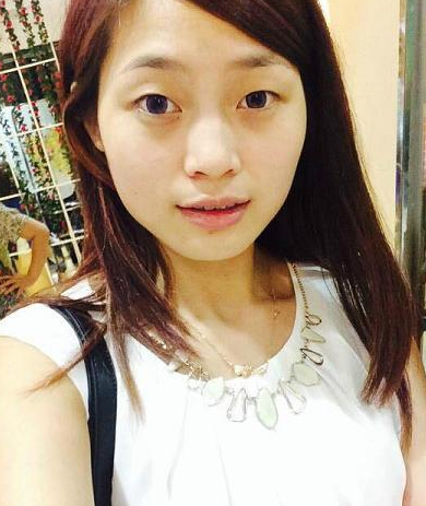 超 声 波双眼 皮让呆萌妹子变著名演员 超 声 波双眼 皮让呆萌妹子变著名演员