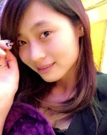 超 声 波双眼 皮让呆萌妹子变著名演员 超 声 波双眼 皮让呆萌妹子变著名演员