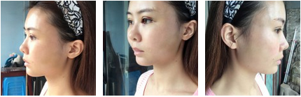 为超 声 波双眼 皮无数点赞 为超 声 波双眼 皮无数点赞