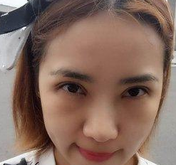 超声波双眼皮让我心灵的鸡汤终于打开啦922 超声波双眼皮让我心灵的鸡汤终于打开啦922